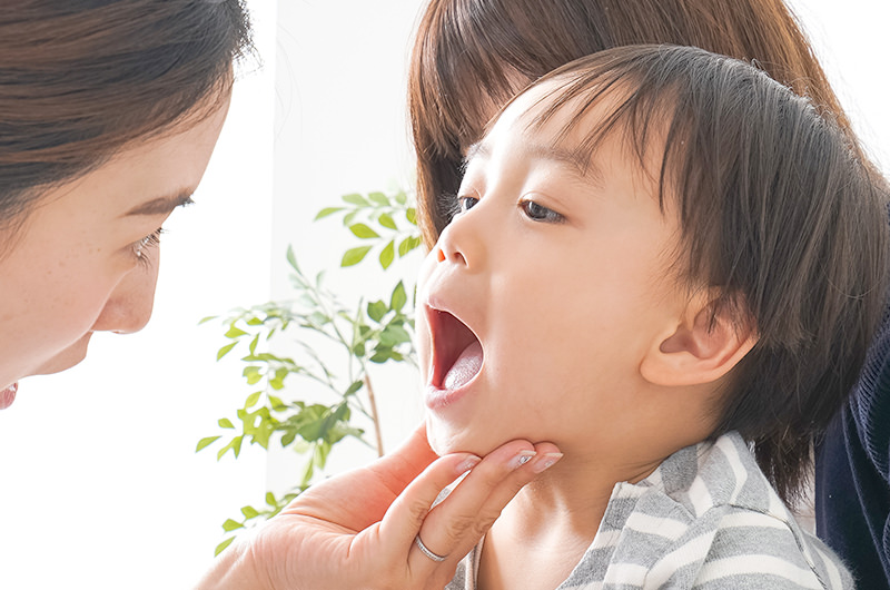 当院の小児歯科治療